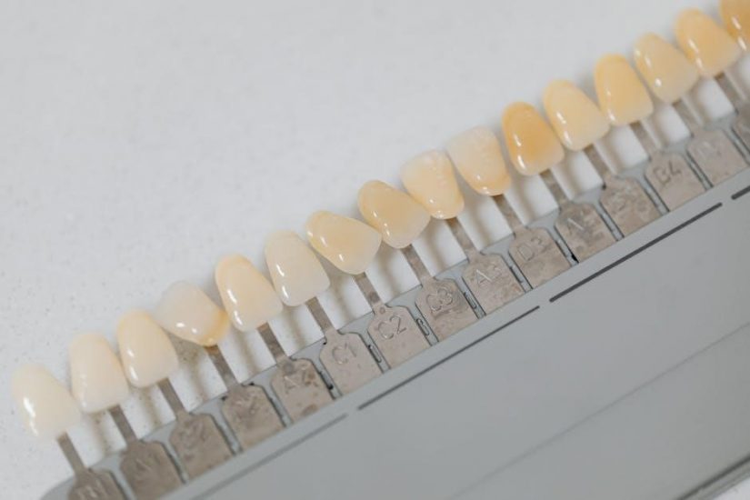 dental instruments a pocket guide